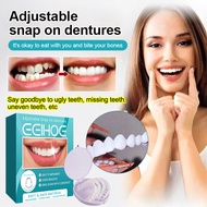 💕Best Sell💕【Invisible braces retainer 】可调节卡扣式假牙Adjustable buckle dentures/Temporary Snap-on Braces /