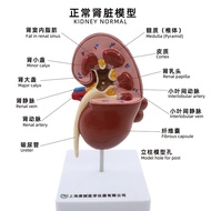 Human Kidney Anatomy Model Disease Change Kidney Model Kidney Model Human Internal Organ Anatomy Mod