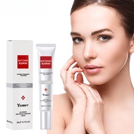 Youbuy Blemish Cream Whitening Blemish Freckles Rejuvenating Moisturizing Blemish Removal Cream Face