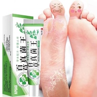 Herbal Anti Fungal Relieve Beriberi Foot Cream Skin Care Toe Treatment Anti Fungal Infection Foot Re