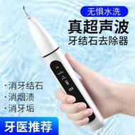 Pembersih Pergigian Ultrasonik Elektrik untuk Kegunaan Rumah, Menanggalkan Kuning, Noda dan Karang, 