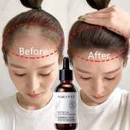 Hair Growth Serum Fast Hair Growth Oil 60ml Anti Hair Loss Serum Growth hair loss supplem Oil Contro