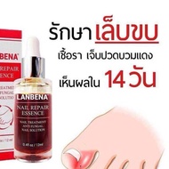 1 แถม1(เซรั่มเล็บแถมตะไบ)LANBENA เซรั่มบำรุงเล็บ ป้องกันเชื้อรา แก้ปัญหาเล็บต่างๆ(แถมฟรี!!ตะไบเล็บ)