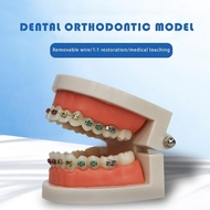 Fake Braces Kids Fake Braces Colorful Braces Wire Braces Lip Protector Teeth Braces Wire Stylish Tee