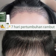 Penumbuh Rambut Penumbuh Rambut Botak 20ml Serum Penumbuh Rambut