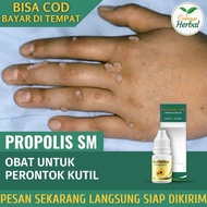 Obat Tetes Penghilang Kutil - Obat Kutil Alami - Obat Kutil di Jari Tangan - Obat Kutil di Leher - O