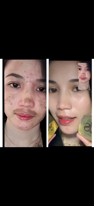 JS SKINCARE Brigtening Night Cream js skincare exclusive krim glowing/ krim flek hitam/krim melasma