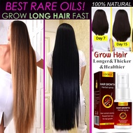 Hair Growth Serum Spray Fast Hair Growth Liquid Treatment Scalp Hair Follicle Anti Hair Loss Natural