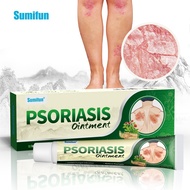 100% Natural Cost Eczema Cream, Herbal Eczema Cream, Moisturizing Cream