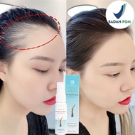 (BPOM)Serum penumbuh rambut Obat penumbuh rambut Penumbuh rambut botak