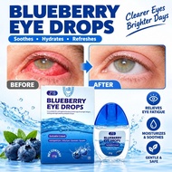 Blueberry eye drops Cataract Dry eyes Pterygium Itchy eyes Glaucoma