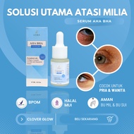 MATA Very Powerful!! Powerful milia Cleanser Serum AHA BHA Special For BPOM milia Very Effective For Overcoming milia Under The Eyes, Cheeks, Noses And Eyelids Formulated With Special AHA BHA Content milia Get Facial Skin Free From milia