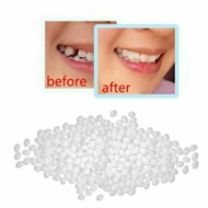 ready stock!! promosi 5 gram temporary teeth,diy gigi palsu