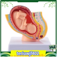 【●TI●】Human Pregnancy Fetal Development 9Th Month Embryonic Pelvic Model Fetus Foetus Pregnancy Anat