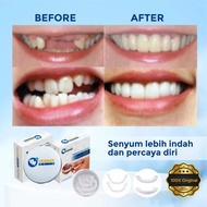 Venner White Gigi Palsu not snap on smile Perapih Gigi Instan ORIGINAL 100%