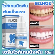 *R H Y*EELHOE ขัดฟันขาว 10มล ทำความสะอาดช่องปาก เซรั่มฟอกฟัน ยาสีฟันขจัดปูน