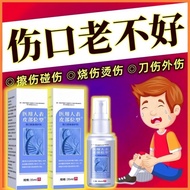 Wound Quick Healing Spray Post-operative Wound Inflammation Extra Wound Scratch Scald Knife Burn Bur