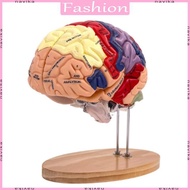 NAV Brain Anatomy Model Brain Pathology Anatomy Teaching Tool Human Organs Model Human Brain Anatomy