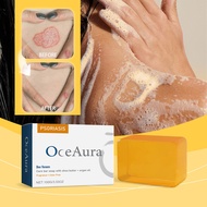 [Ready Stock] Bee Venom Cowhide Moss Care Soap Moisturizing Repair Body Skin Itching Red Swelling An