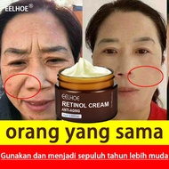 retinol cream Anti Aging Cream anti wrinkle cream moisturizer and cream retinol moisturizer repair w