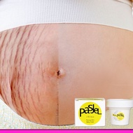 Pregnancy obesity wrinkle repair cream, fade care repair cream, fade wrinkle cream