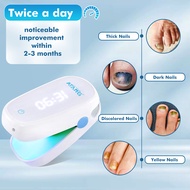 Fungal Nail Laser Treatment Repair Fast Nails Fungus Onychomycosis Repair Toenail Fingernail Removes