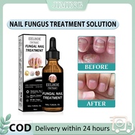 EELHOE Nail Repair Solution Onychomycosis Repair Solution Treatment of Onychomycosis Nail Thickening