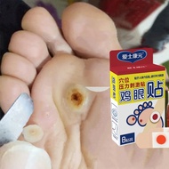 wart remover kutil kolestrol remover ubat ketuat ubat hilangkan tahi lalat ubat ketuat Foot Warts Re