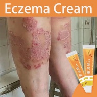 Eczema Cream Krim Gatal Psoriasis Cream Antifungal Cream Itchy Effectively Solves Itchy Skin 湿疹霜