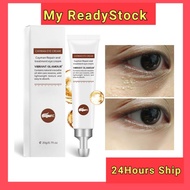 Dark eyes circle Hyaluronic Acid Eye Cream Vitamin E Eye Gel Dark Circles Moisturize Under Eye Cream Eye Care dark circle