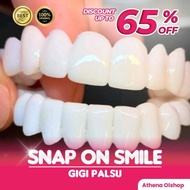 Langsung Snap On Smile 100% Orinal Authentic / Gi Palsu Snap On Smile