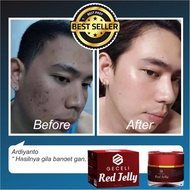 cream Pria Penghilang Noda Hitam Akibat Bekas Jerawat cair pemutih-wajah cream anti acne flek hitam