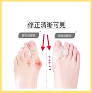 全城熱賣 - ［1對裝］矽膠腳拇趾分趾保護套改善腳趾外翻柔軟舒適