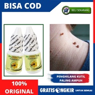 Obat Penghilang Kutil - Kutil Di Leher Bahu - Obat Alami Pengempis Kutil - Kutilan - Obat Buat Ngila