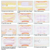 Dental Whitening Kit 35% Hydrogen Peroxyde  Whiten Teeth Bleach Gel Oral Care Quickly Remove Tooth S