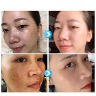 hk2 Whitening Freckle Essence Remove Dark Spots Anti Freckle Essence