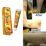 asli Eczema Treatment Anti Bacterial Skin Fungus Cream藏药皮宝 止痒 抗菌湿疹