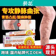 Sunflower Veins Dedicated Green Tendons Protruding Acid Hemp Expansion Pain Veins Soothing Worm Legs