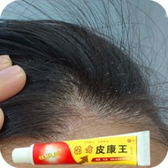 Ready Scalp Itchy Scalp Dandruff Scalp Repeated Scab Scalp Cowhide Silver Dandruff Ups Scalp White S
