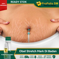 Obat Stretch Mark Di Perut Paha Leher Betis Obat Penghilang Stretch Mark Obat Guratan/Garis Di Kulit