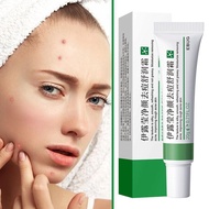 Acne Care Moisturizing Cream, 20g Oil Control & Hydrating Face Cream For Balanced Skin, O8b7