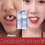 [READY STOCK] Gigi Palsu Penambal gigi berlubang Gigi palsu asli