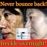 3 days to arrive remove pigment dark spots scar moisturizing cream facial brightening Spot Removal Cream 30g 祛斑霜326