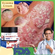 eczema cream obat gatal untuk kulit krim gatal kulit  ubat gatal celah kangkang ubat gatal kemaluan 