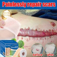 Scar Tape Medical Silicone Scar Sheet Scar Removal Scar Patch Keloid Scar Plaster Skin Repair Sticke