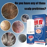 Seborrheic Dermatitis Spray Scalp Treatment Psoriasis Anti Dandruff Ubat Kulit Kepala Berkuping Itch