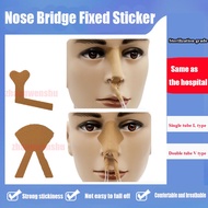 stick fixed jambatan nose fixed tubes tetap post nasogastric tube 20pcs sticker feeding catheter pel