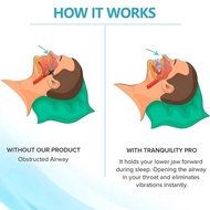Anti Snoring Bruxism Mouth Guard Improve Sleeping Teeth And Apnea