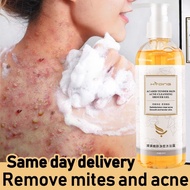 acne body wash acne wash body anti acne body 260ml  wash back acne body wash benzoyl peroxide body w