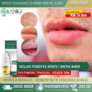 Obat Alami Bibir Bintik Putih Obat Penghilang Ruam Dekat Bibir Obat Alergi Bibir Bengkak Gatal Obat 